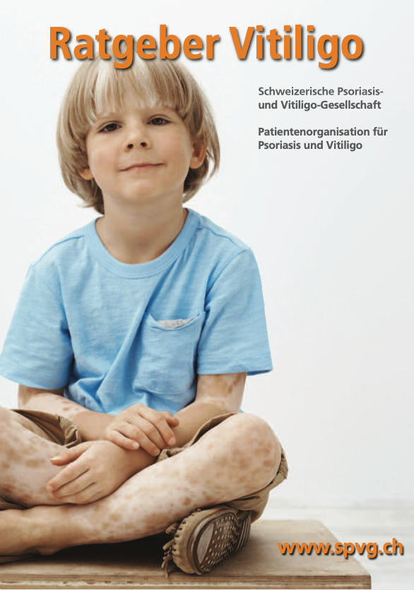 ratgeber vitiligo