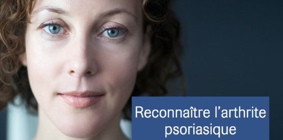 psoriasis arthritis fr 792x390px