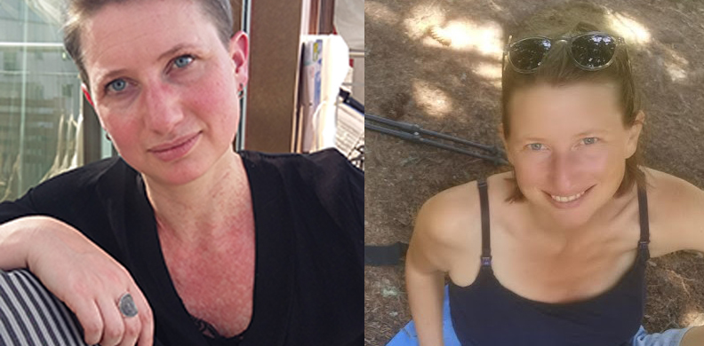 carmen vorher nachher